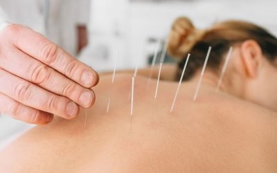 Pourquoi recourir à un acupuncteur sur Essonne ?
