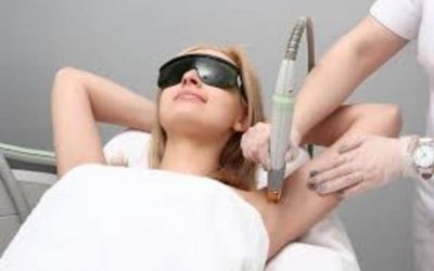 L’épilation au laser : quelques informations nécessaires à savoir