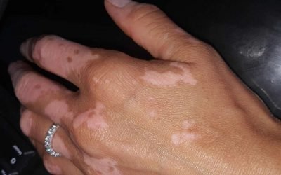 Lotion vs fond de teint : que choisir ?